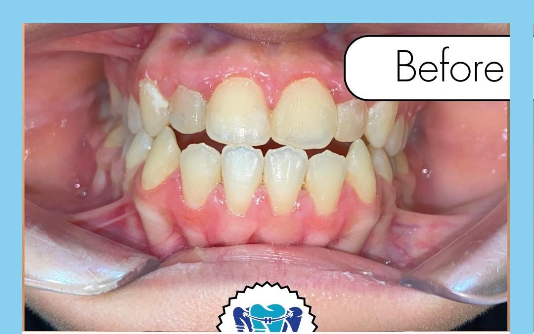 504380880_1212786210862266_5229836524722649364_n 504380880_1212786210862266_5229836524722649364_n