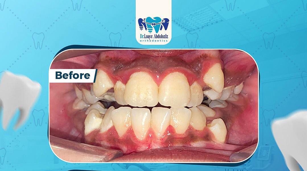 539251049_1235508848590002_1923319763064642592_n 539251049_1235508848590002_1923319763064642592_n